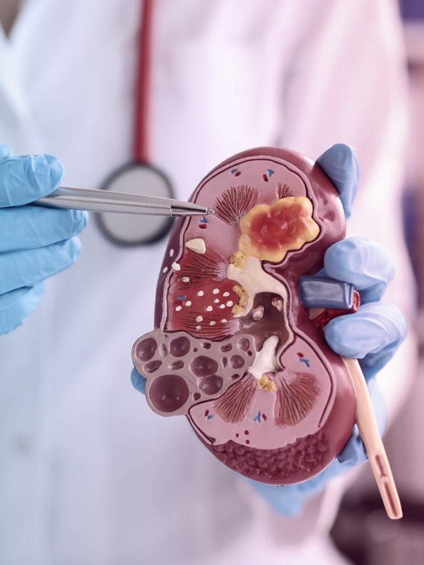 Specialist explaining a kidney model